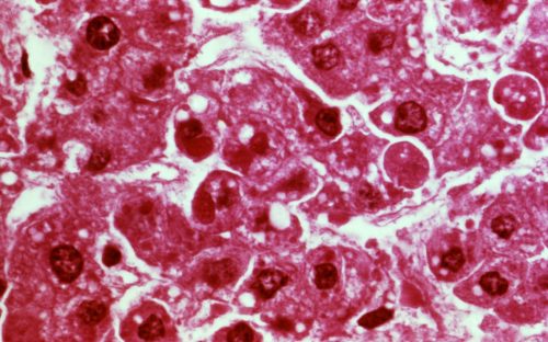 Ebola pathogen is a member of the filoviridae family of rna viru