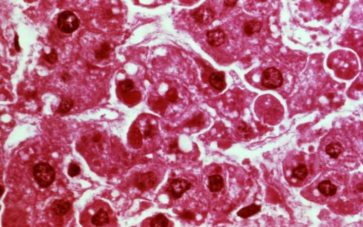 Ebola pathogen is a member of the filoviridae family of rna viru